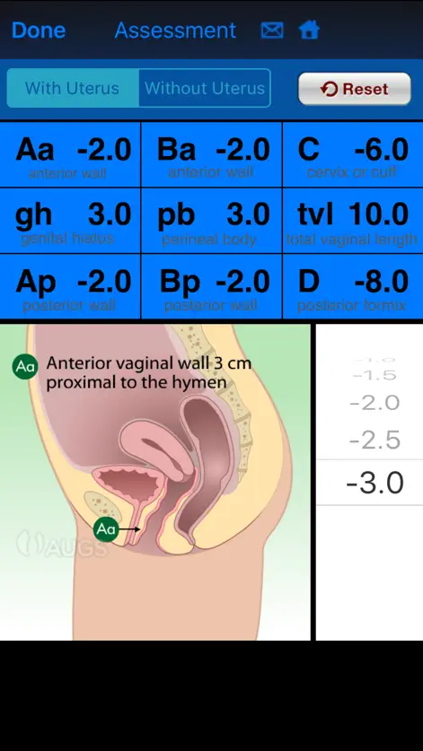 AUGS POP-Q - Medical App | MWM