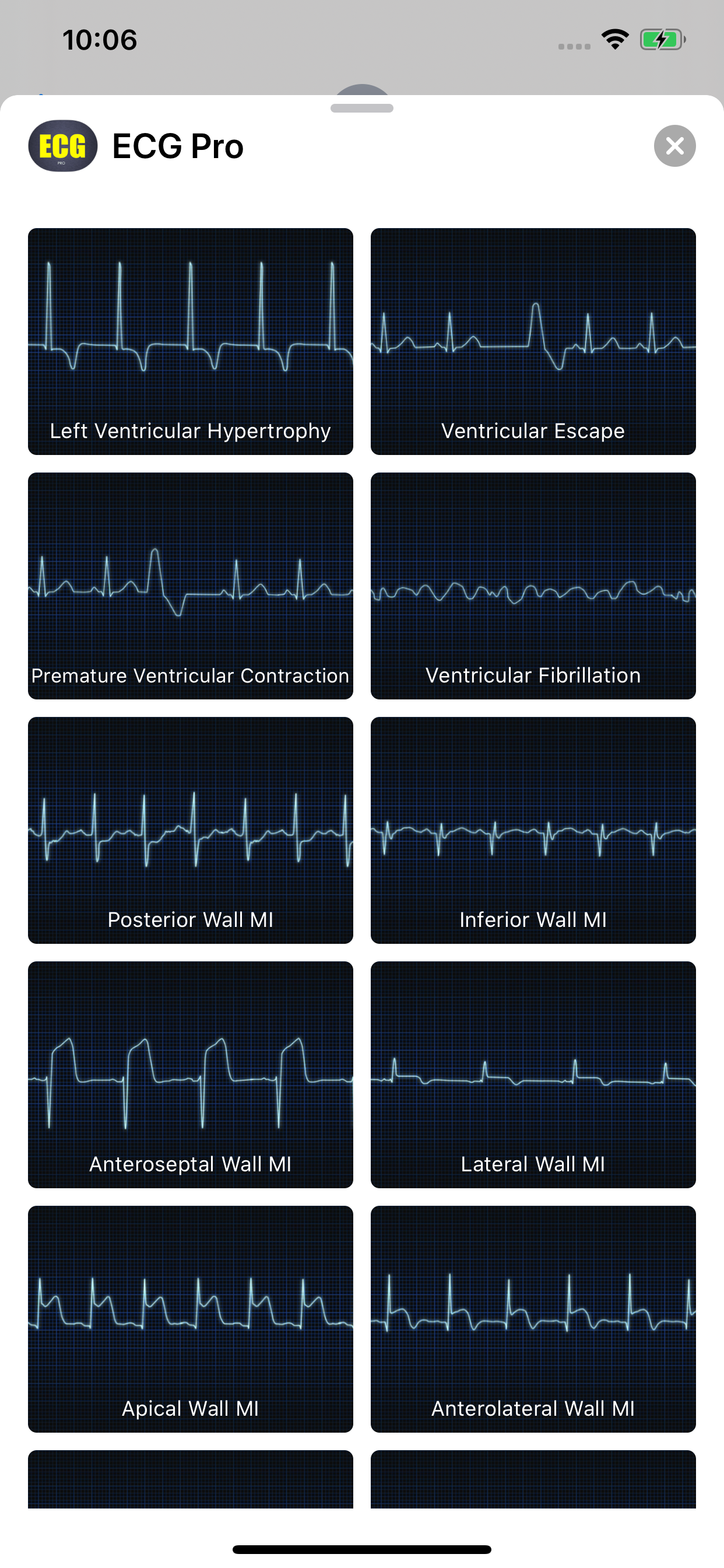 ECG Pro for Doctors