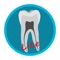 Dental Corpus TOOTH ANATOMY LITE is a demonstration version of TOOTH ANATOMY
