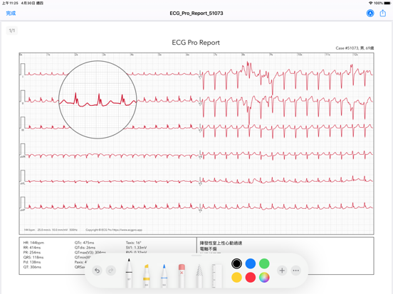 ECG Pro for Doctorsのおすすめ画像8