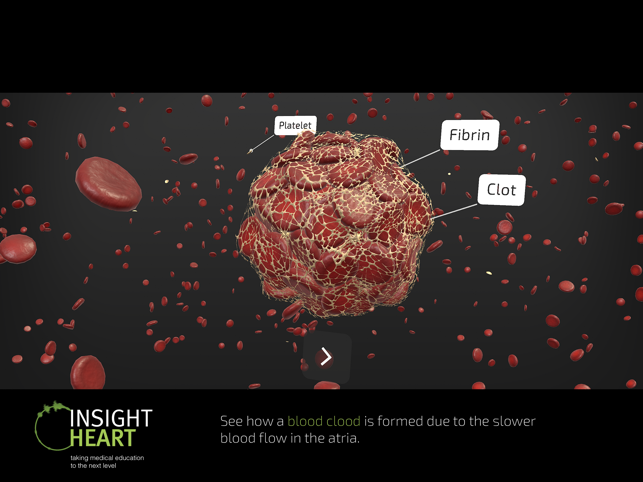 ‎INSIGHT HEART Screenshot