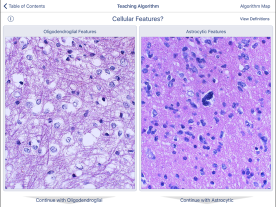 Screenshot #6 pour Johns Hopkins Atlas of Surgical Neuropathology