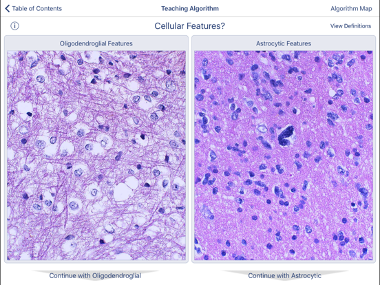 Johns Hopkins Atlas of Surgical Neuropathologyのおすすめ画像3