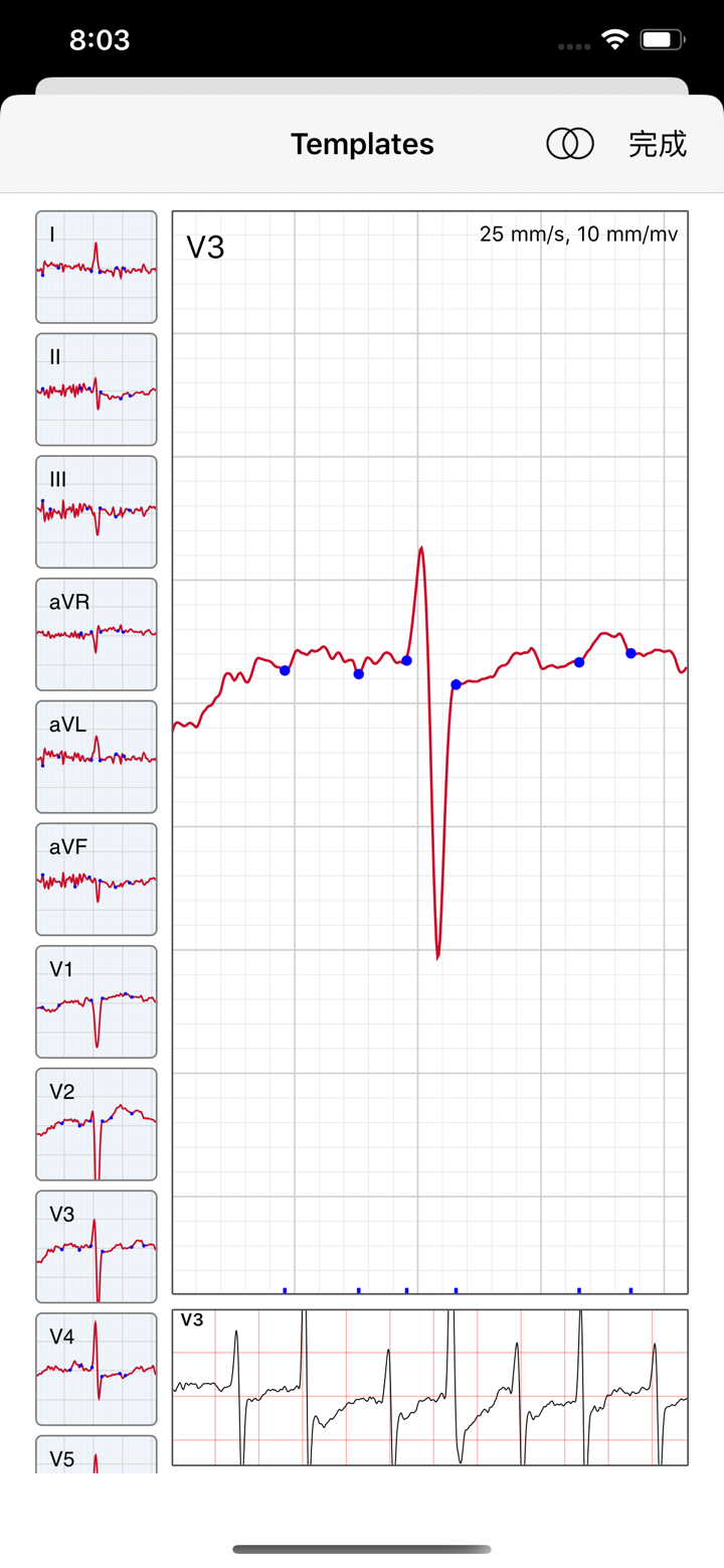 ECG for Doctors screenshot 8