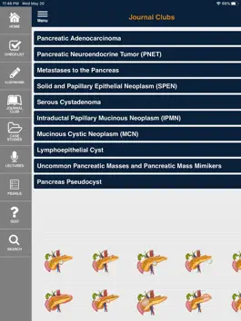 Game screenshot CTisus Pancreas Compendium hack