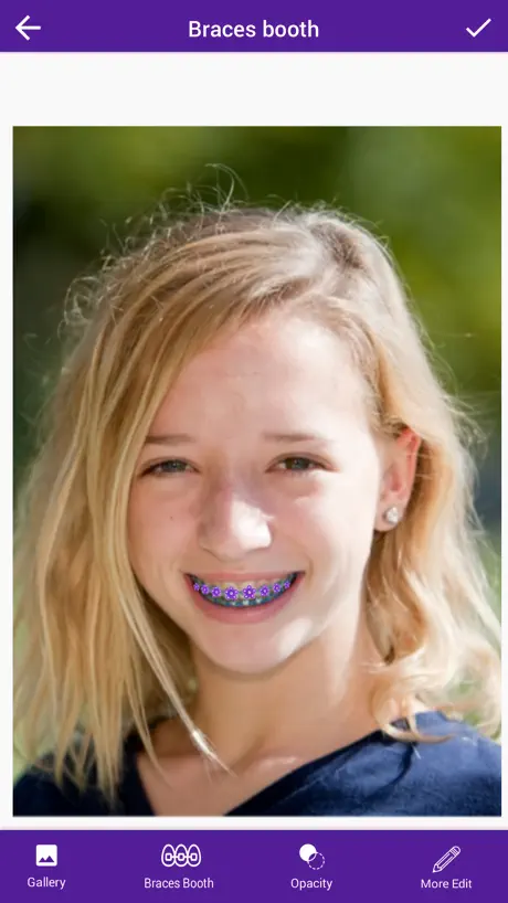 Braces Camera Photo Editor