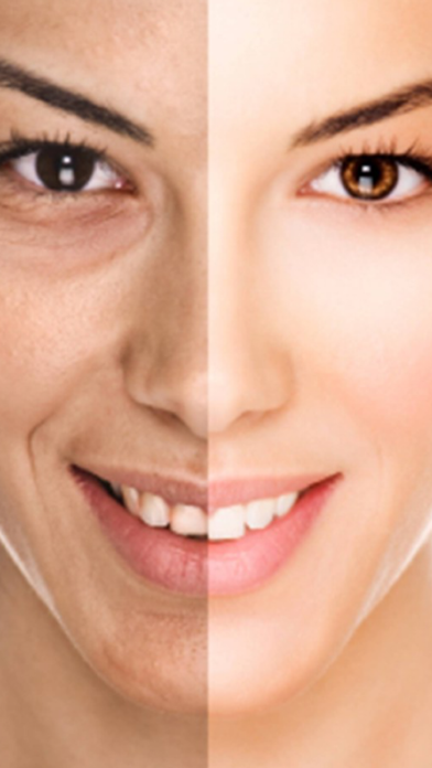 Look Younger - Perform Plastic Surgery on Photosのおすすめ画像1