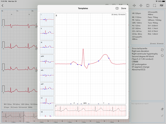 ECG for Doctors iPad screenshot 7 - Medical app