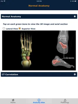 Game screenshot CTisus: CT of the Foot hack