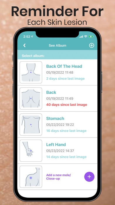 Mole Checker Skin Dermatology Screenshot