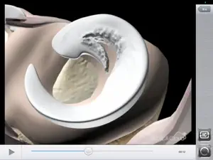 IC動画HD screenshot 1