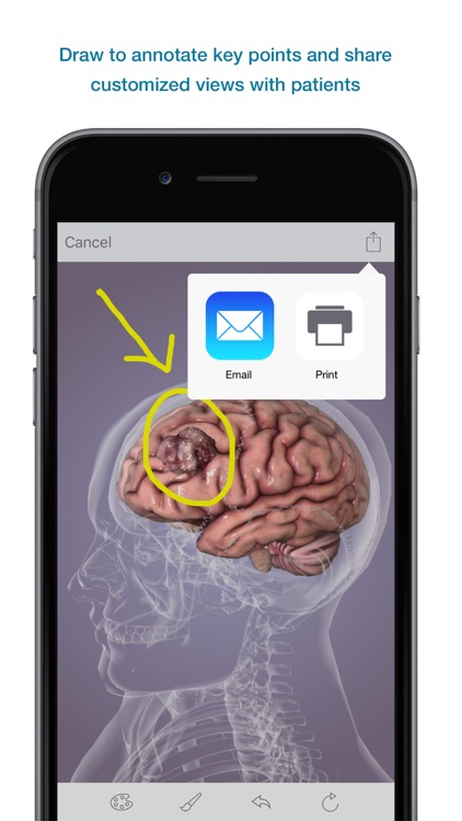 3D Body Explorer for Oncology + Hematology