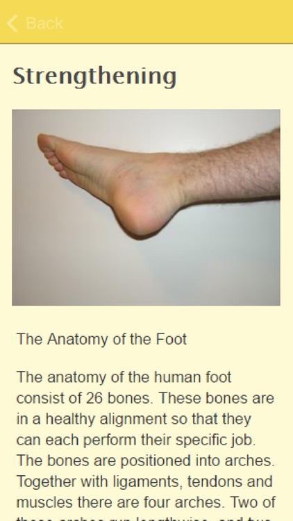 Symptoms Of Fallen Arches