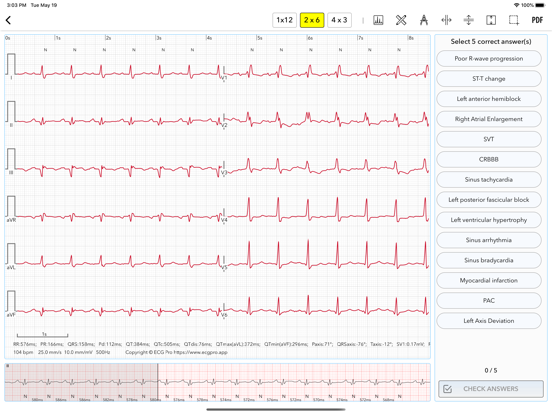 ECG for Doctors iPad screenshot 5 - Medical app