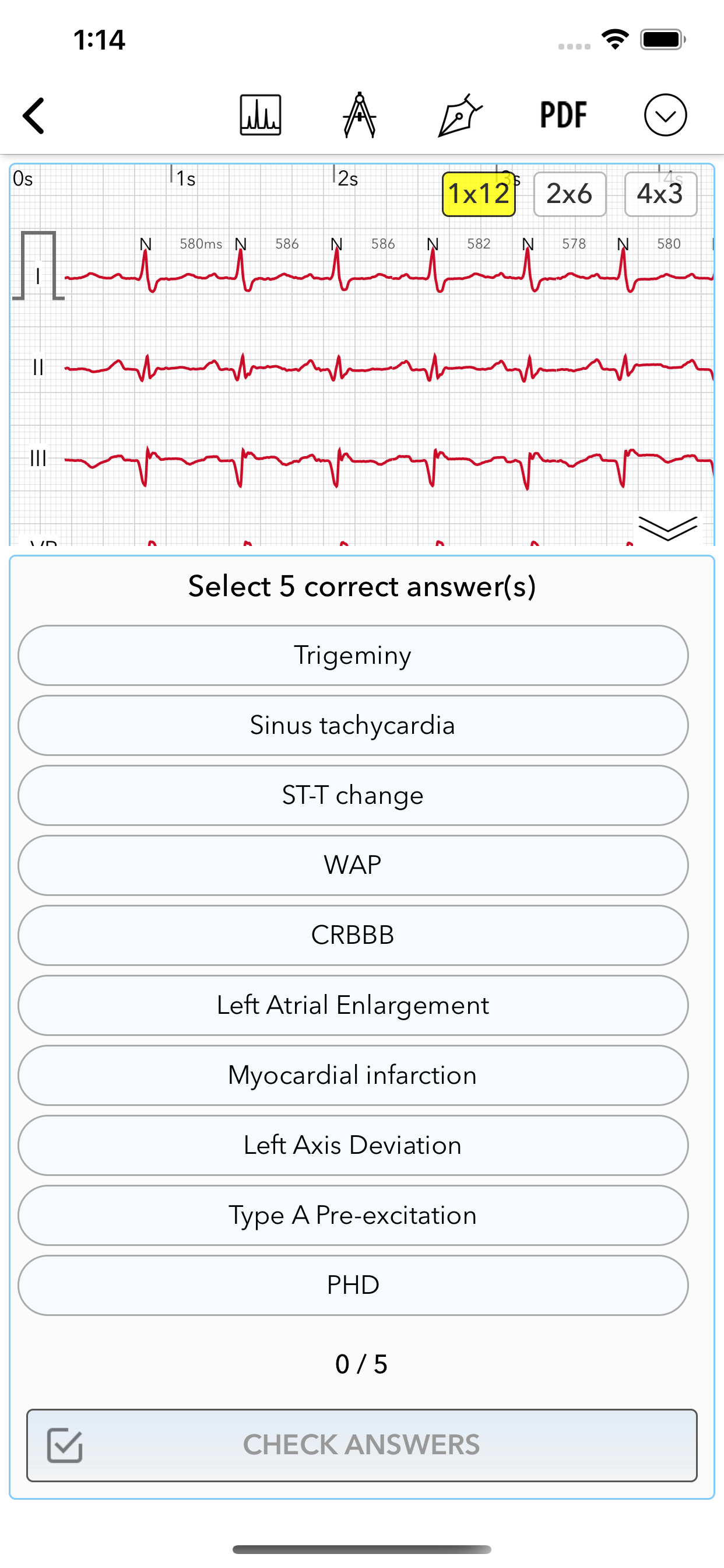 ECG Pro for Doctors