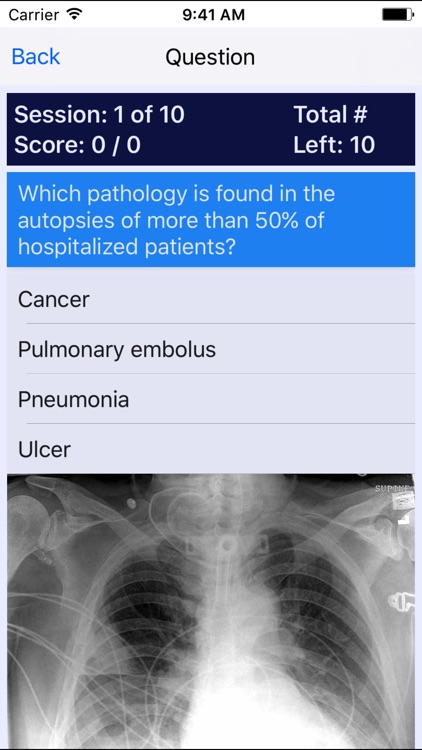 Oncology Board Review