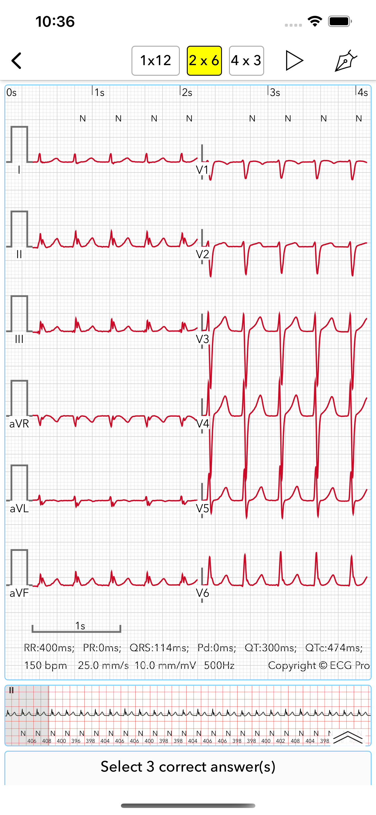 ECG Test for Doctors