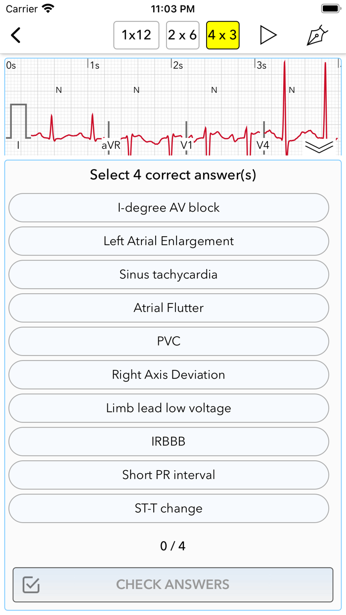 ECG Test for Doctors
