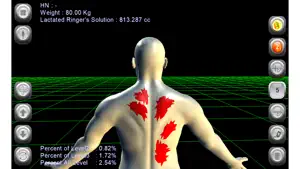 3D Burn Resuscitation screenshot #2 for iPhone