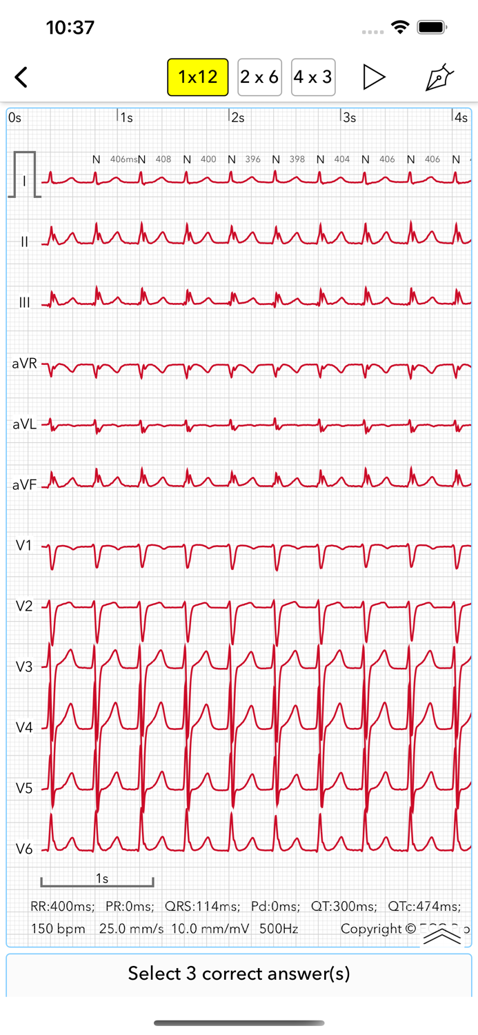 ECG Test Pro for Doctors
