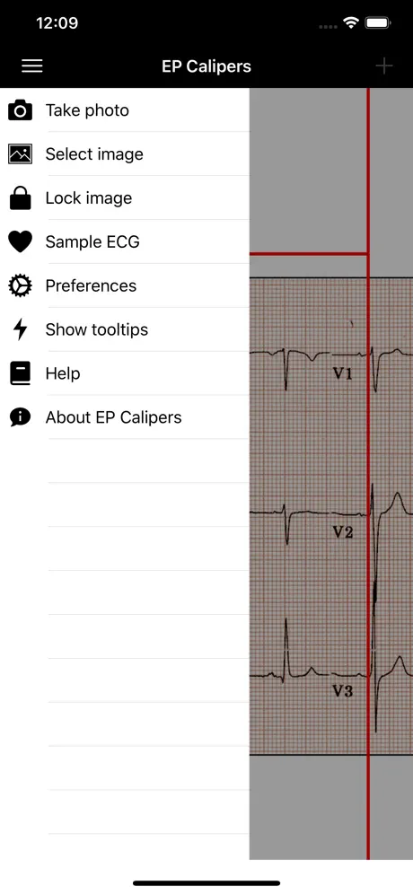 EP Calipers