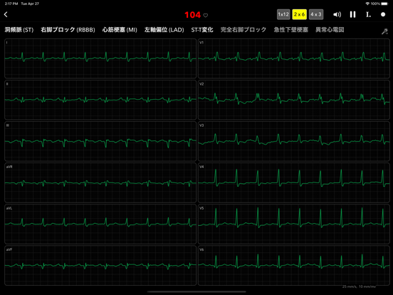 ECG Pro for Doctorsのおすすめ画像4