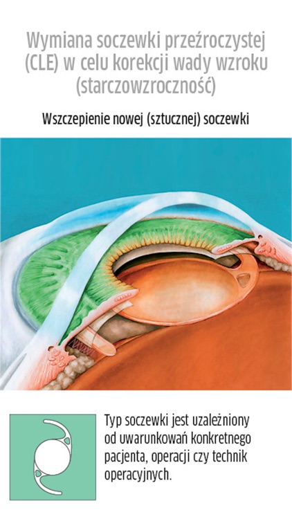 Atlas Okulistyka PTO