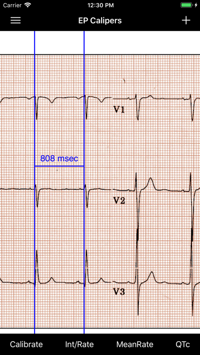 EP Calipers Screenshot