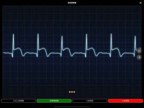 ECG Test Proのおすすめ画像1