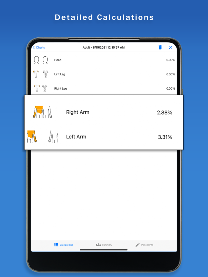Surface Burn Calculator