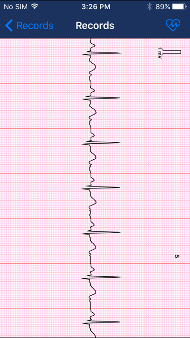 Screenshot #3 pour Beurer CardioExpert