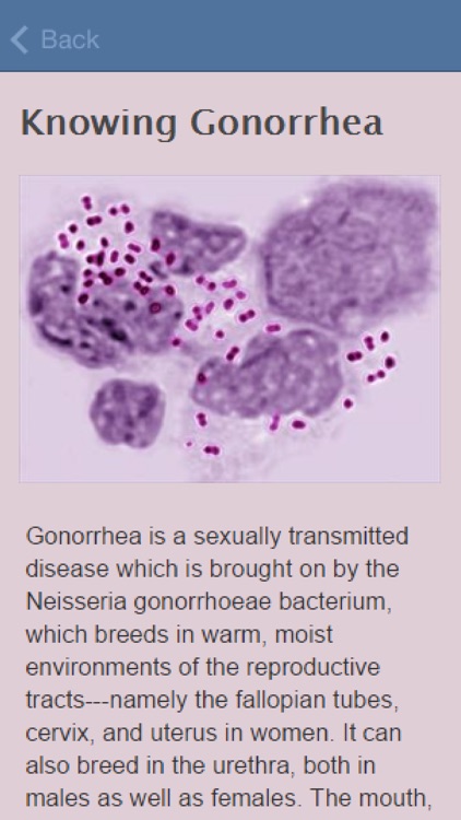 Symptoms Of Gonorrhea