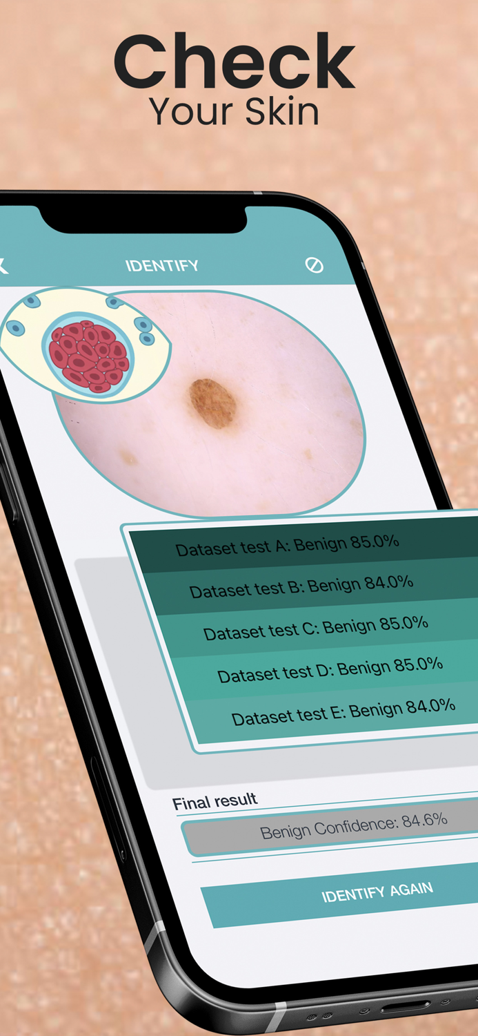 Mole Checker Skin Dermatology