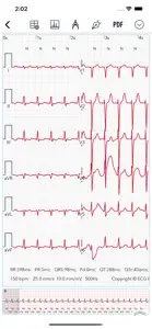 ECG for Doctors screenshot #2 for iPhone