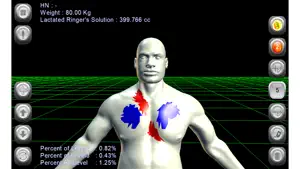 3D Burn Resuscitation screenshot #1 for iPhone