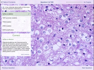 Johns Hopkins Atlas of Surgical Neuropathology screenshot #4 for iPad