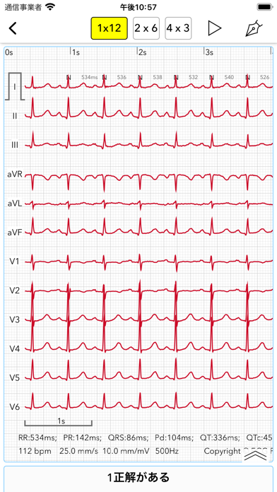 ECG Testのおすすめ画像3