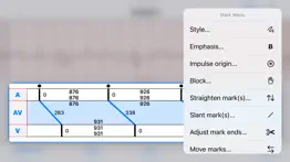 ep diagram iphone screenshot 4