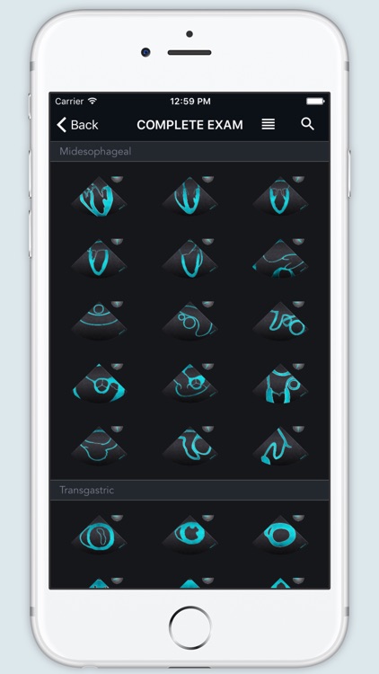 ECHO Views - Transesophageal Echocardiography