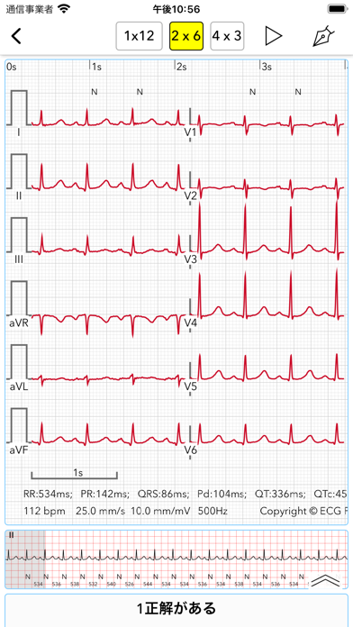 ECG Testのおすすめ画像6