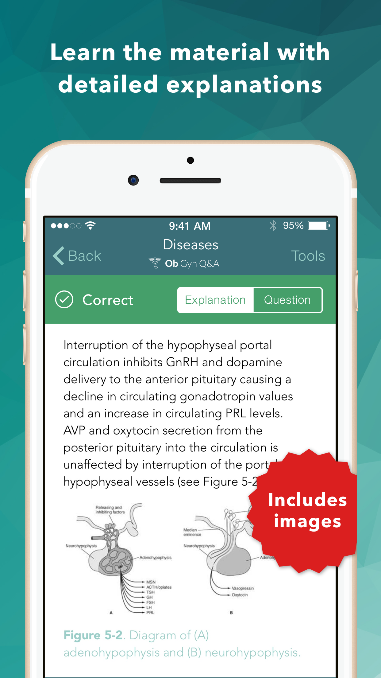 USMLE LANGE Q&A for Ob Gyn