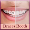 Braces Teeth Sticker.s – Fun Dentist Photo Edit.or