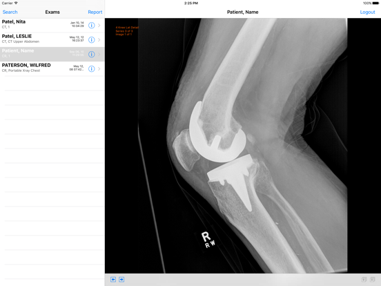 Screenshot #5 pour VoyagerPACS