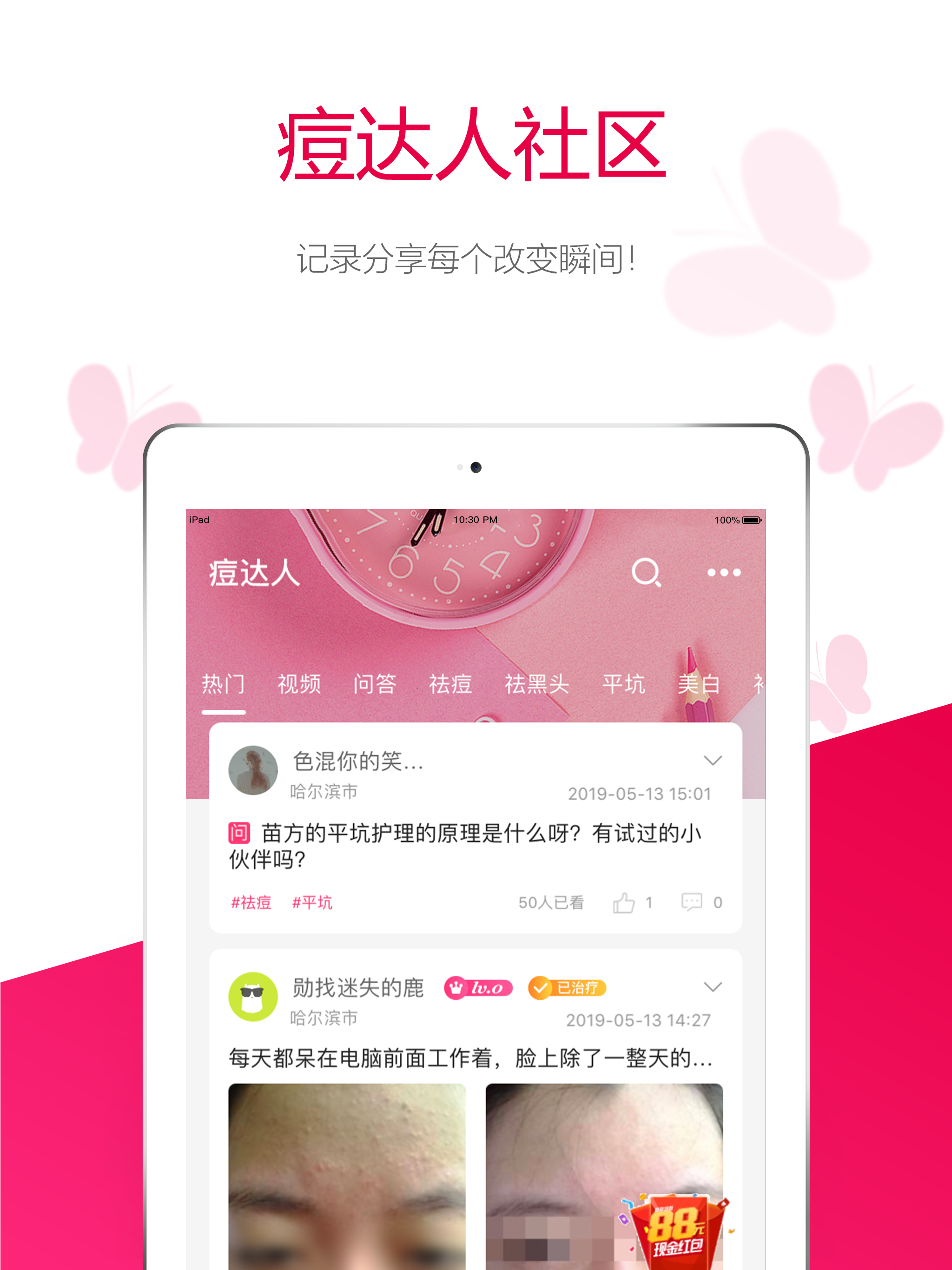 苗方清颜-专业祛痘