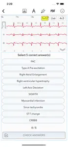 ECG for Doctors screenshot #6 for iPhone