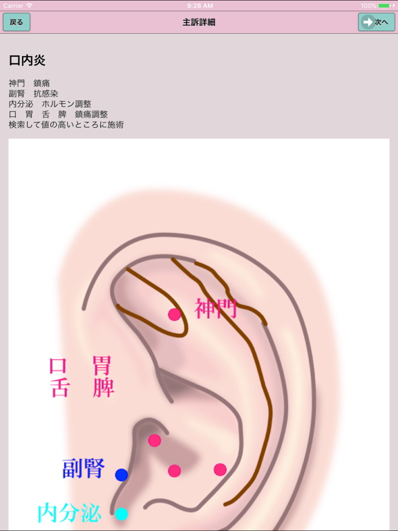 Screenshot #5 pour 耳つぼエイト