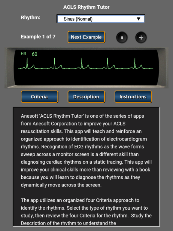 Screenshot #4 pour ACLS Rhythm Tutor