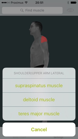 Dry Needling Guide(圖5)-速報App