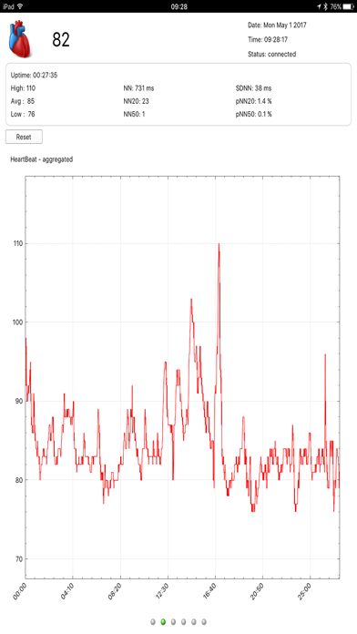 HeartBeat Visualisation screenshot