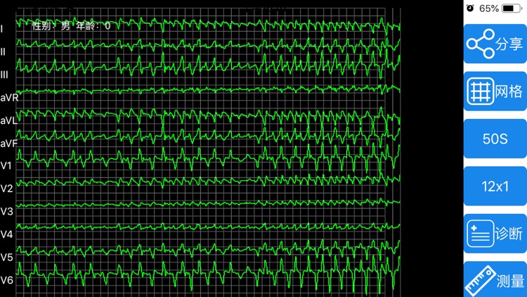 区域-心干线 screenshot-4